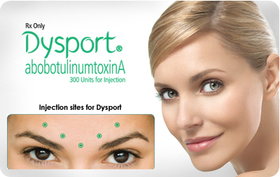 dysport-botox-alternative